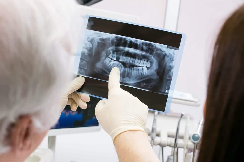 Dental Xray